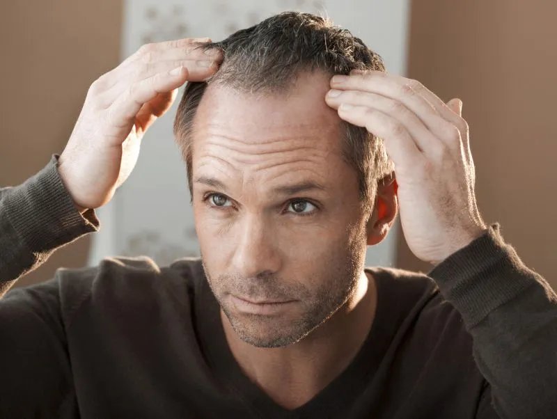 头发掉光了怎么办