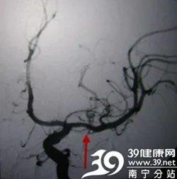 访瑞康医院神经内科主任任丁