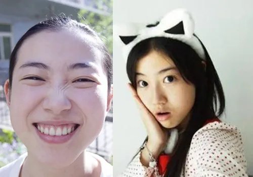 女神张辛苑素颜照曝光  网友纷纷质疑整容后遗症