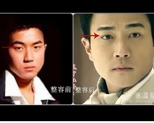 刘恺威以前的照片曝光 堪称假面之王