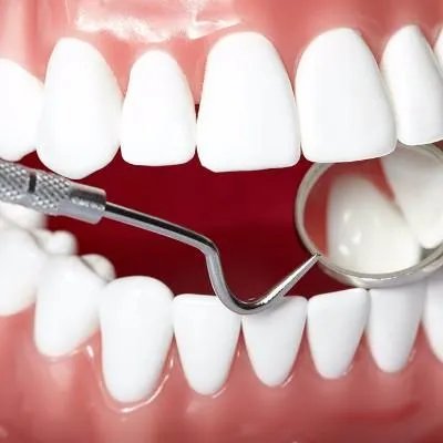 牙齿黄是什么原因