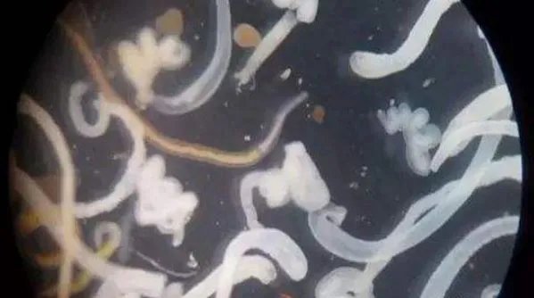 寄生虫进入身体后，会发出哪些信号？为何会被感染？