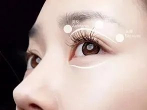 8种双眼皮整容失败症状以及修复