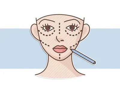 韩国曝幽灵整容数百人丧命：被整形毁掉的中国女孩，还有多少？