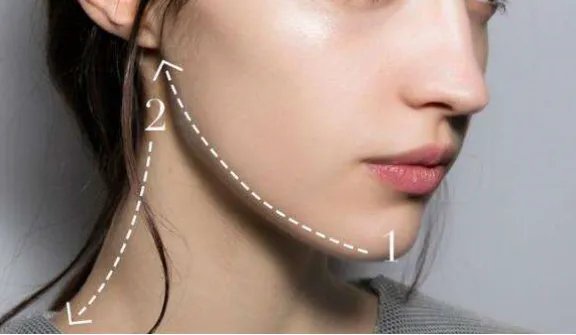 注射botox瘦脸要多少价格