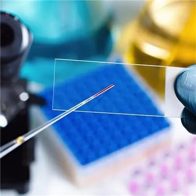 肾病综合征能活多久