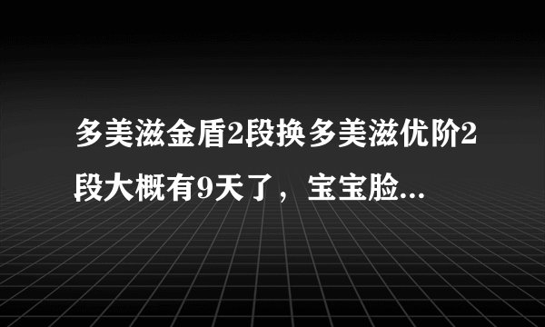 多美滋金盾2段换多美滋优阶2段大概有9天了，宝宝脸上一直出现湿疹怎么办？