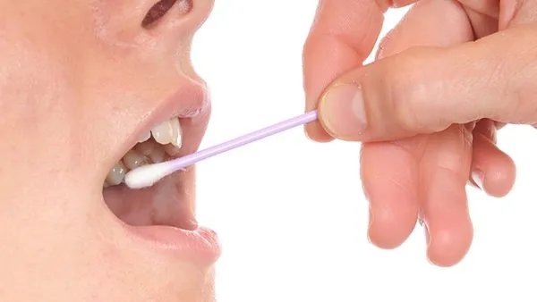 牙痛可以吃什么止痛药