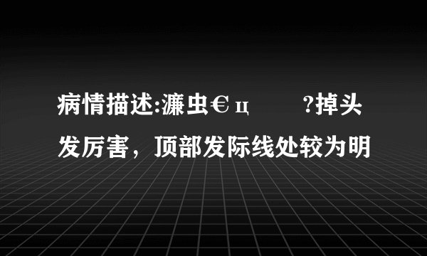 病情描述:濂虫€ц劚鍙?掉头发厉害，顶部发际线处较为明