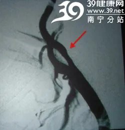 访瑞康医院神经内科主任任丁