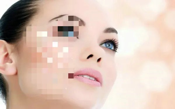 瓜子脸整形多少钱