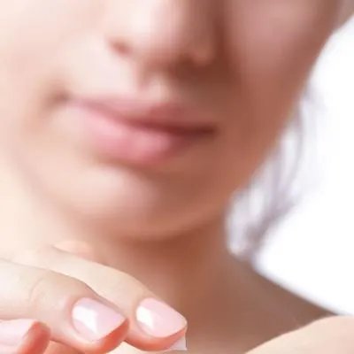 治疗青春痘医院哪家最好