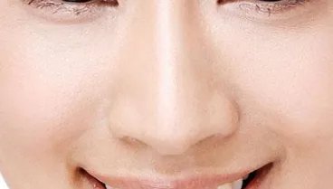 鼻孔整形哪家医院做得好