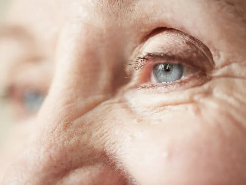 去除眼袋的小窍门