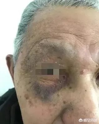 大连失火的地标留下黑色伤疤1800多人有家难归