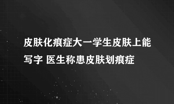 皮肤化痕症大一学生皮肤上能写字 医生称患皮肤划痕症