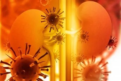 肾移植感染新冠