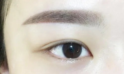 哪里开眼角比较好