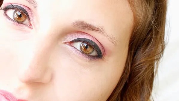 怎么去除眼角皱纹