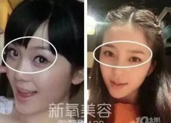 赵韩樱子整容前后：赵韩樱子是姓什么