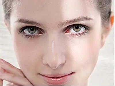 割双眼皮手术的坏处是什么