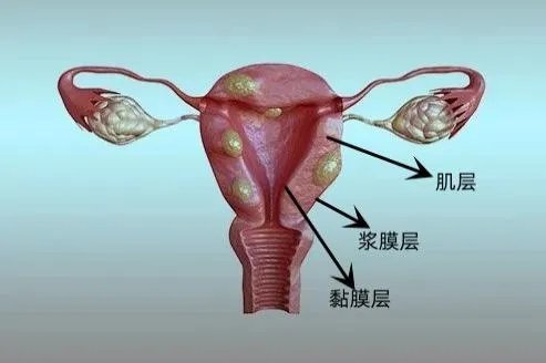 子宫分层由内向外图