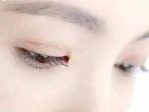 8种双眼皮整容失败症状以及修复