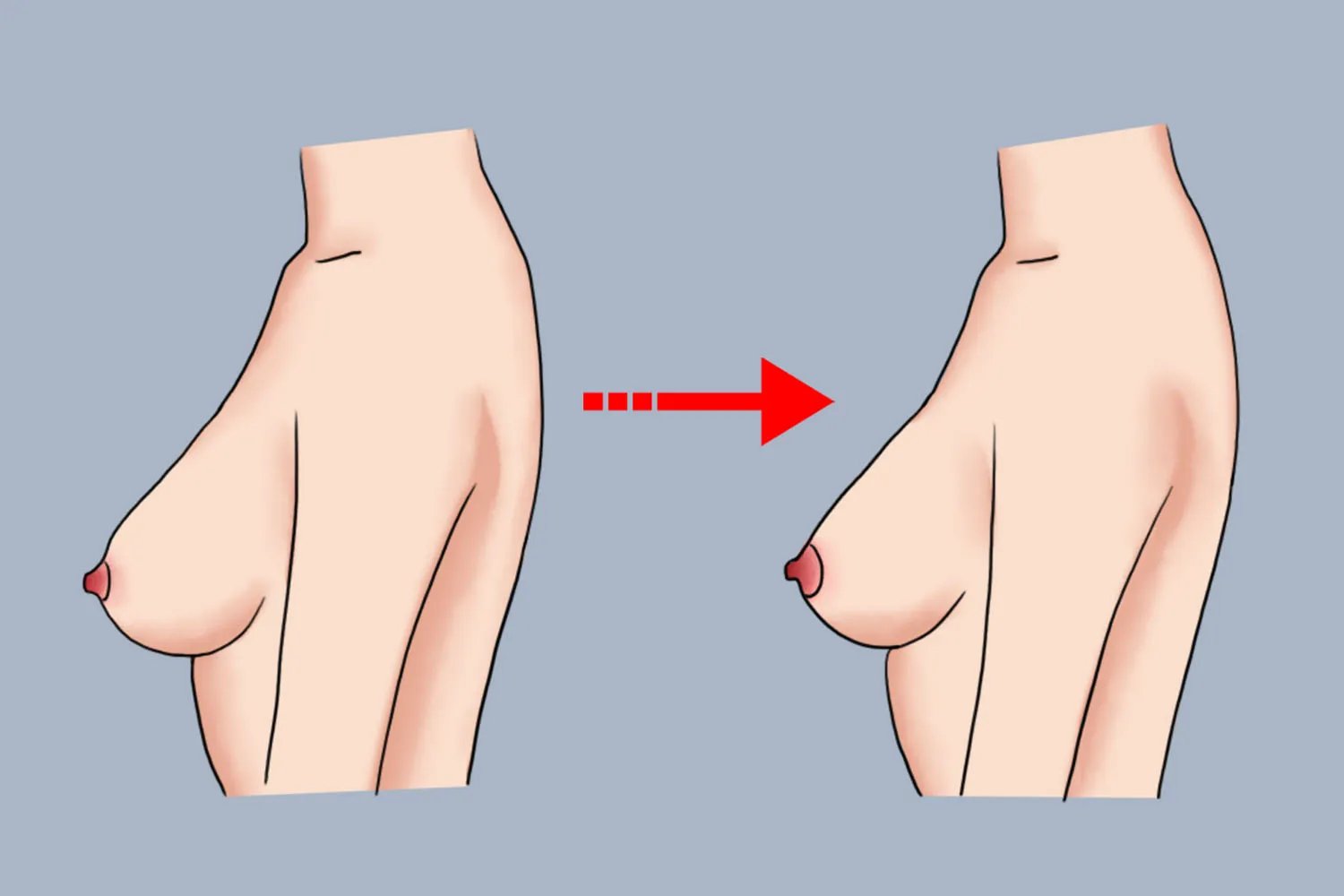 怀孕和没怀孕的区别图片