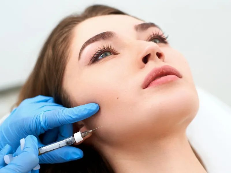 玻尿酸除法令纹的注意事项