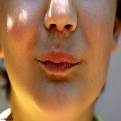 鼻孔里有血丝是怎么回事