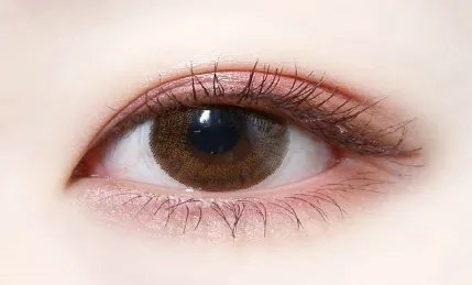 韩式定点双眼皮拆线吗