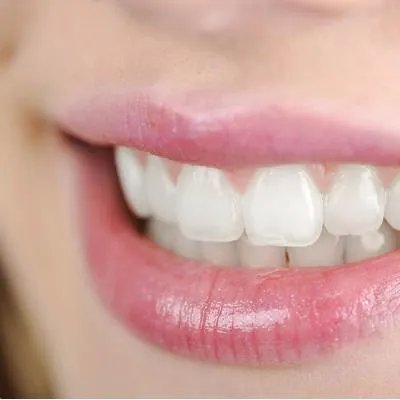 牙齿黄是什么原因