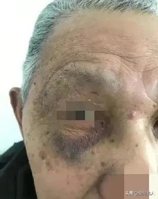 大连失火的地标留下黑色伤疤1800多人有家难归