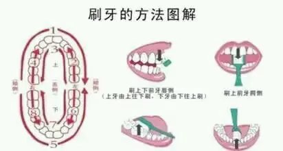 日常护牙小贴士