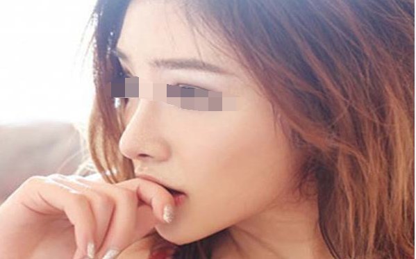 广州疤痕修复多少钱