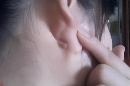 耳后淋巴位置图真人