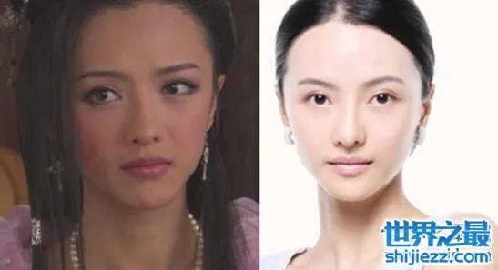 张芷溪整容前后对比照片,面部整容疤痕清晰可见