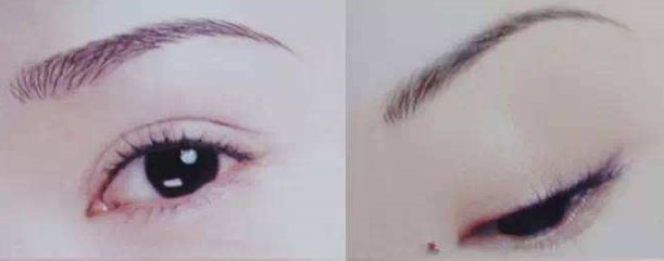 纹眉术和绣眉术的效果对比图