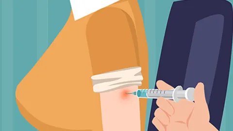 注射玻尿酸除皱效果如何