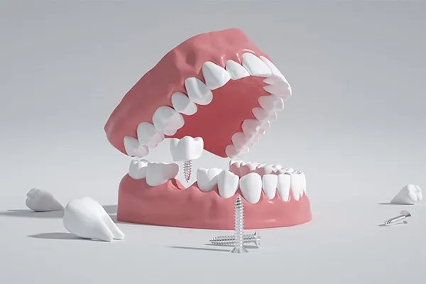 门牙有缝怎么治