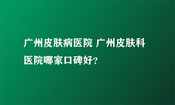 广州皮肤病医院 广州皮肤科医院哪家口碑好？