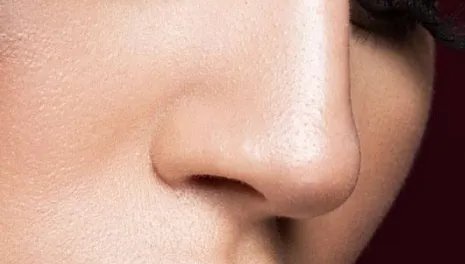 上海鼻头缩小医院哪儿好