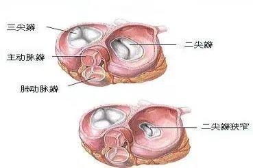 心脏几个瓣膜的位置及图解