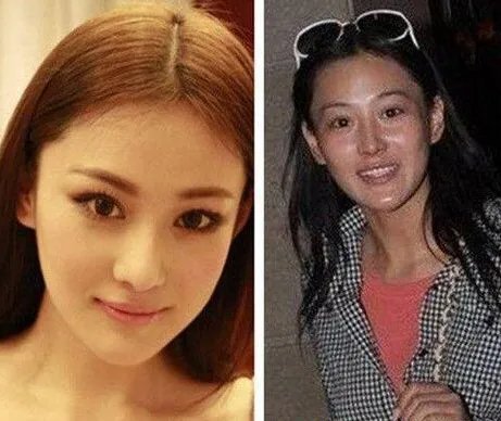 张馨予整容前素颜遭曝光 网友直呼惨不忍睹