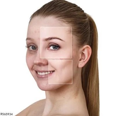 怎么淡斑有效果