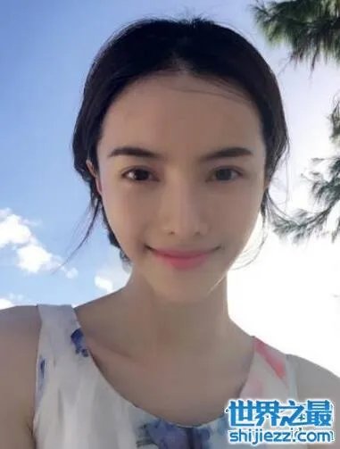 张芷溪整容前后对比照片,面部整容疤痕清晰可见