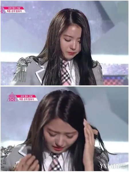 韩国女星鼻子坍塌惹热议整容事故为何频发