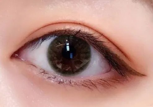 单眼皮怎样变双眼皮