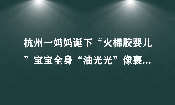 杭州一妈妈诞下“火棉胶婴儿”宝宝全身“油光光”像裹了一层羊皮纸!