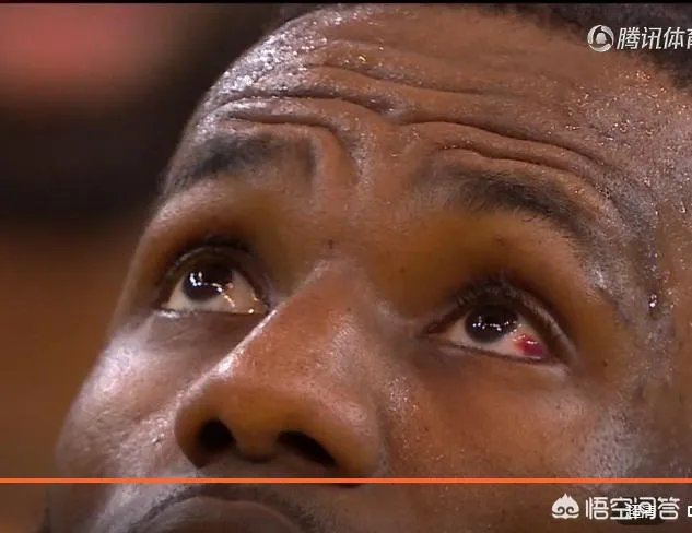 詹姆斯被格林打到眼睛，视力模糊，总决赛G2会休战一场吗？